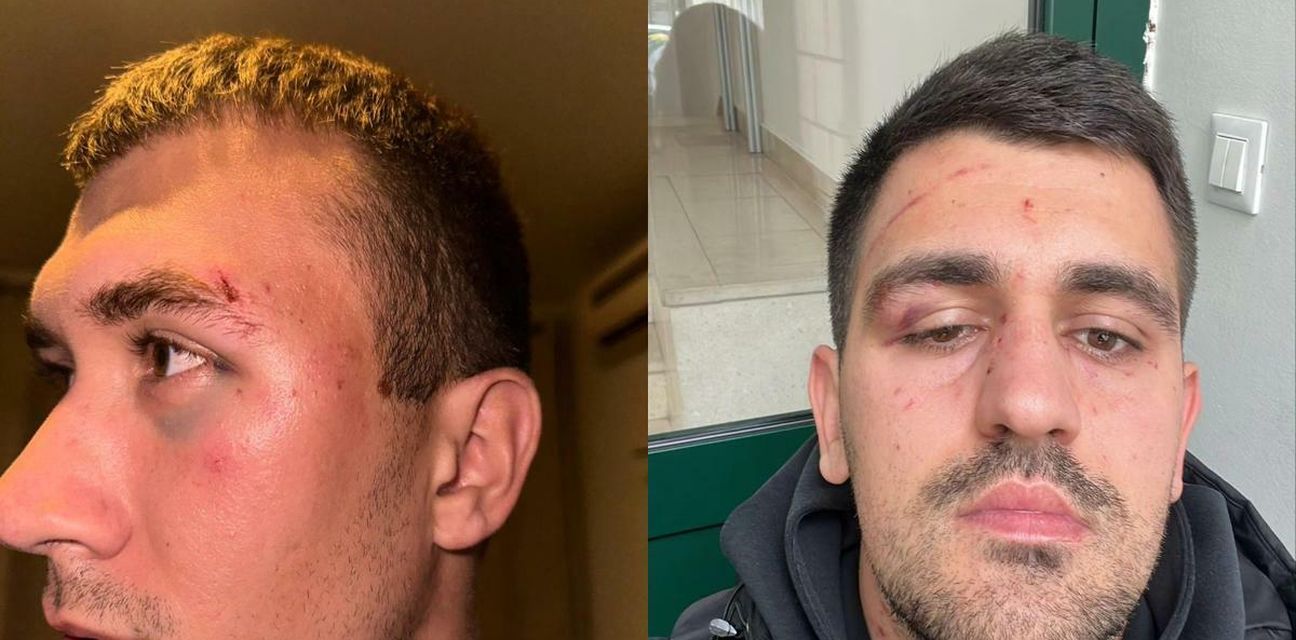 Nogometaši u Dalmaciji pretučeni nakon utakmice, tukao ih i predsjednik protivničkog kluba?