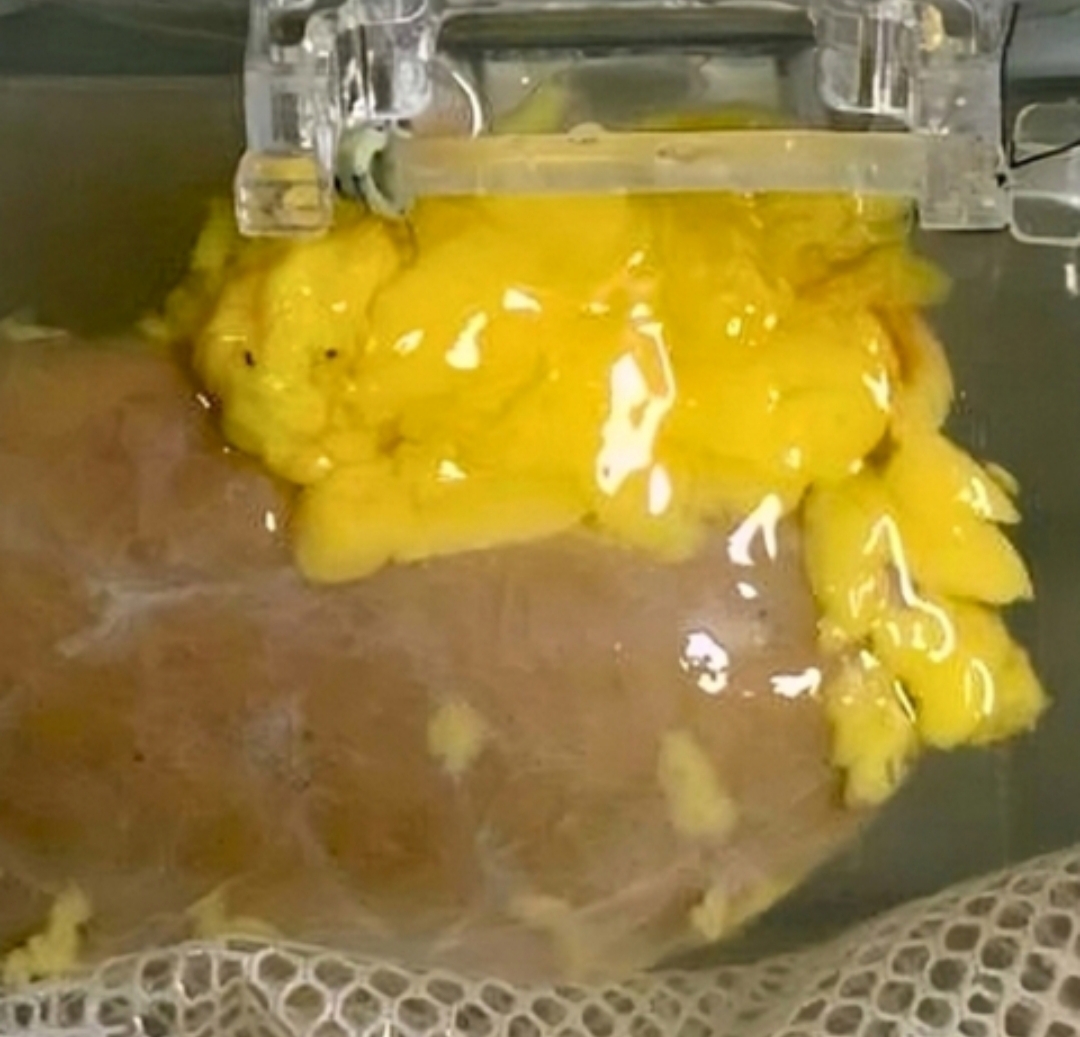 Znanstvenici razvili „univerzalni“ bubreg koji može odgovarati svim krvnim grupama