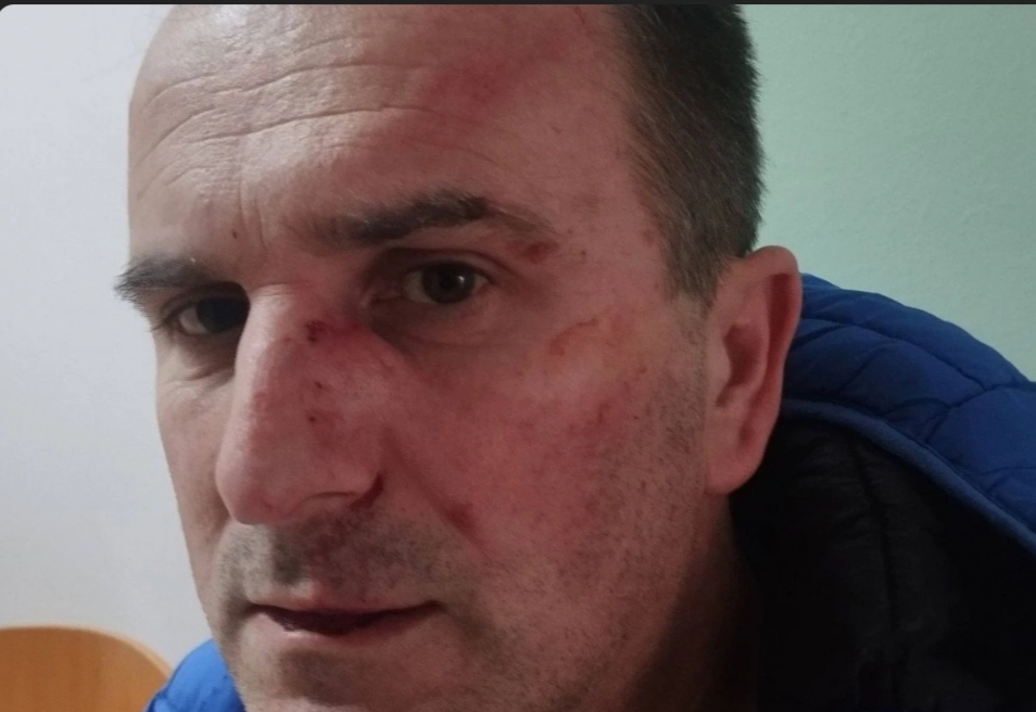 Pretučen aktivist koji je razotkrio “tender sa ludim cijenama”: od kašike od 60 KM do veš-mašine od 23.000 KM