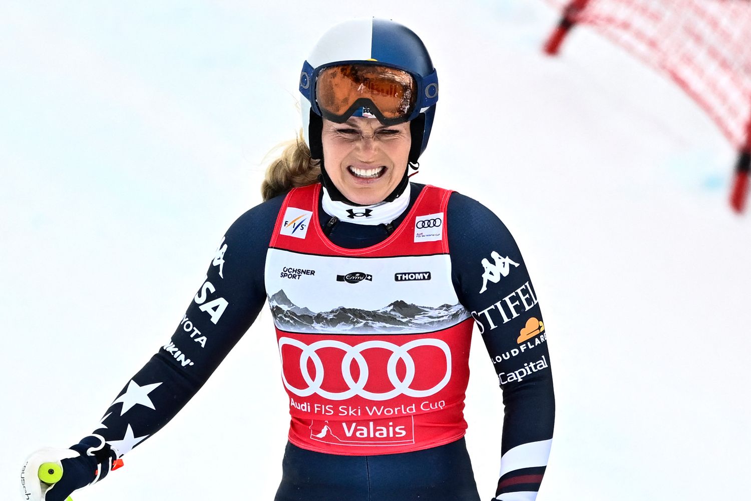 Vonn bi mogla snositi doživotne posljedice nakon teške ozljede na ZOI